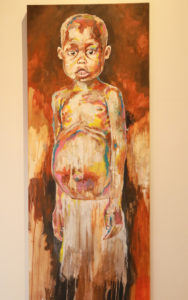 Noguera expresses the prevalence of malnutrition and parasites in “Perdido con Hambre (Lost and Hungry).”